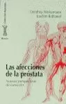 AFECCIONES DE LA PROSTATA,LAS