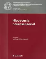 HIPOACUSIA NEUROSENSORIAL