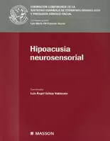 HIPOACUSIA NEUROSENSORIAL HIPOACUSIA NEUROSENSORIAL