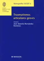 TRAUMATISMOS ARTICULARES GRAVES TRAUMATISMOS ARTICULARES GRAVES