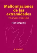 MALFORMACIONES DE LAS EXTREMIDADES