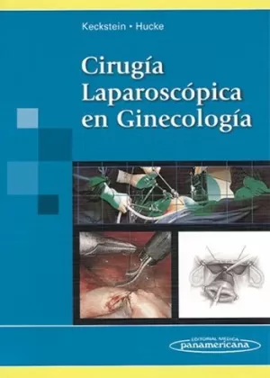 CIRUGIA LAPAROSCOPIA EN GINECOLOGIA