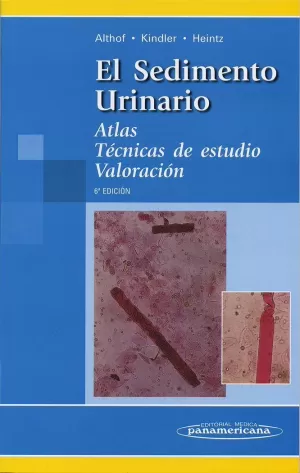 SEDIMENTO URINARIO 6ºEDIC SEDIMENTO URINARIO 6ºEDIC