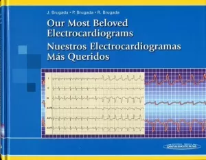 NUESTROS ELECTROCARDIOGRAMAS MAS QUERIDOS