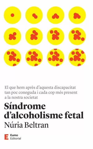 SÍNDROME D'ALCOHOLISME FETAL